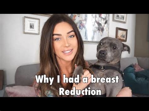 lucie wilde breast reduction|MY BREAST REDUCTION SURGERY: Why I Had It, Hospital。